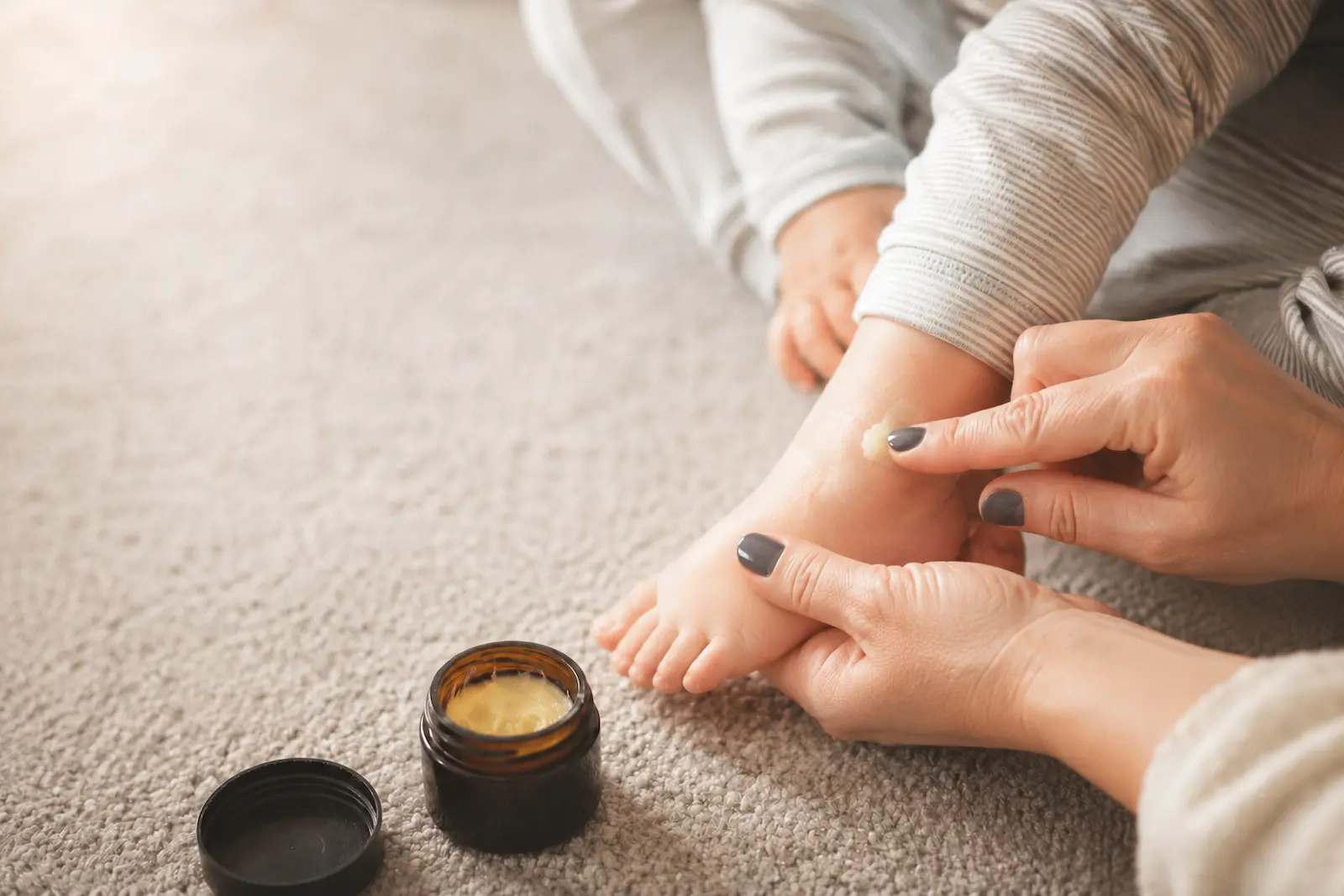 Nahaufnahme einer Salbe auf dem Finger – sanfte Hautpflege im akuten Neurodermitis-Schub.